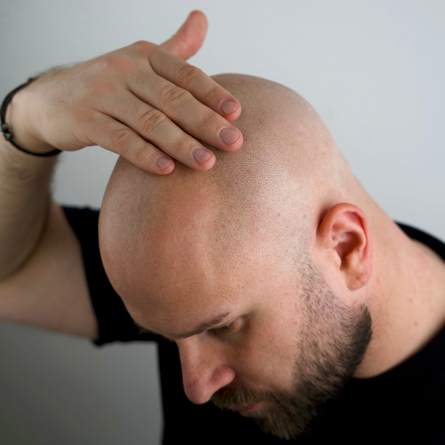 BETTER BE BOLD - Magic Bald Head & Beard Oil